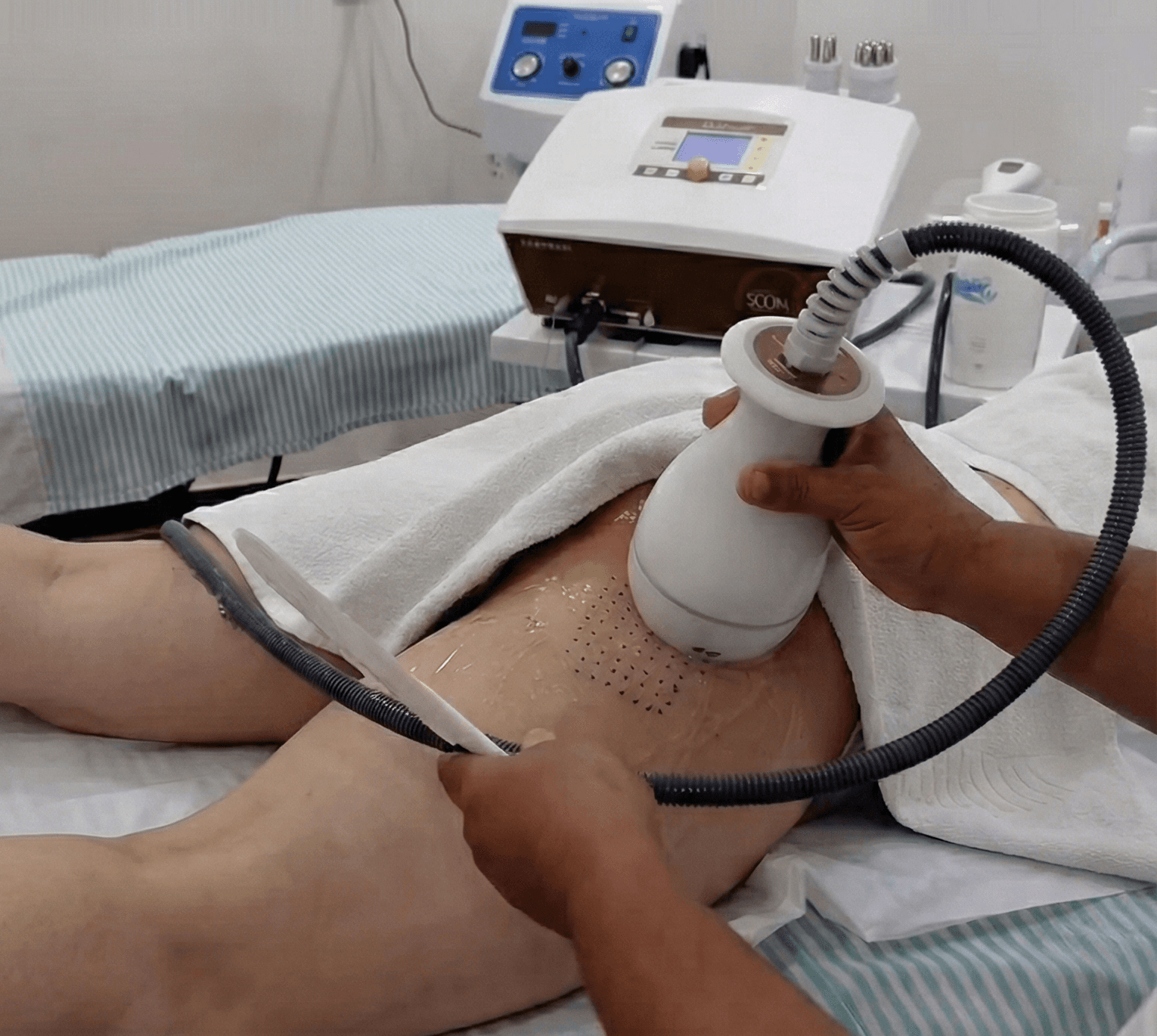 Tratamentos Corporais